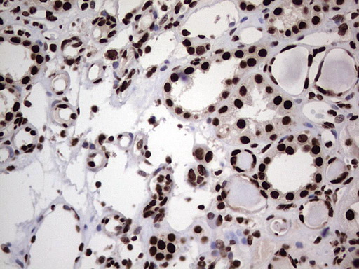 m03769 anti hnrnp l hnrnpl mouse monoclonal antibody clone id oti2e4 ihc testing 18