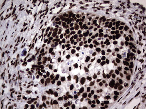 m03769 anti hnrnp l hnrnpl mouse monoclonal antibody clone id oti2e4 ihc testing 19