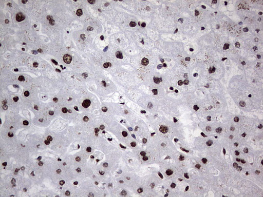 m03769 anti hnrnp l hnrnpl mouse monoclonal antibody clone id oti2e4 ihc testing 20