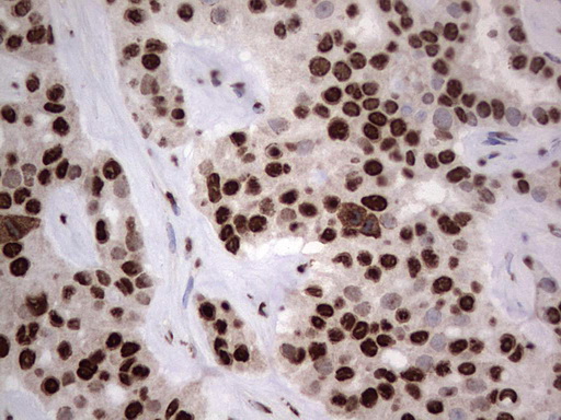 m03769 anti hnrnp l hnrnpl mouse monoclonal antibody clone id oti2e4 ihc testing 21