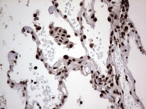 m03769 anti hnrnp l hnrnpl mouse monoclonal antibody clone id oti2e4 ihc testing 22