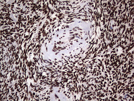 Immunohistochemical staining of paraffin-embedded Human Ovary tissue within the normal limits using anti-HNRNPL mouse monoclonal antibody