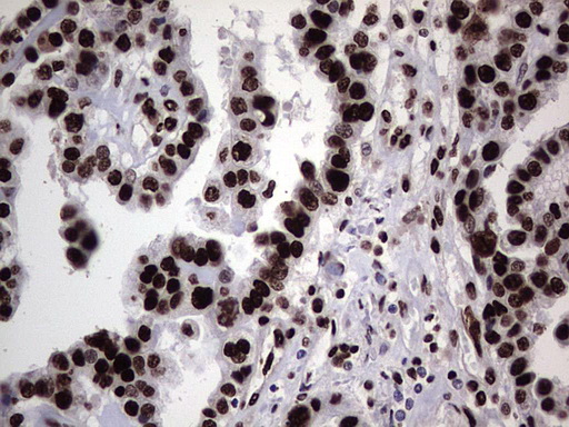 m03769 anti hnrnp l hnrnpl mouse monoclonal antibody clone id oti2e4 ihc testing 4