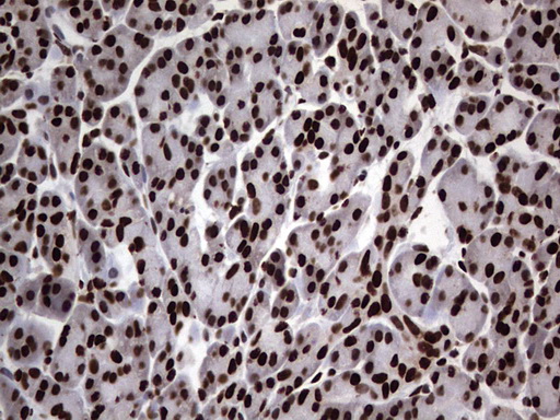 m03769 anti hnrnp l hnrnpl mouse monoclonal antibody clone id oti2e4 ihc testing 5