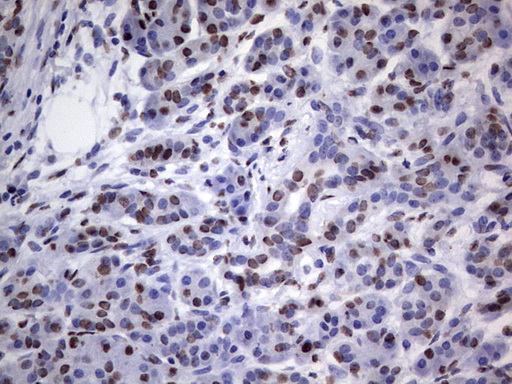 m03769 anti hnrnp l hnrnpl mouse monoclonal antibody clone id oti2e4 ihc testing 6