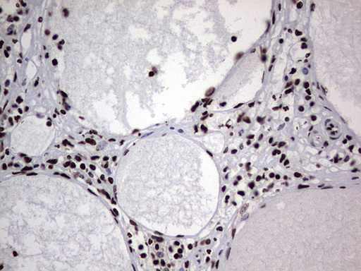 m03769 anti hnrnp l hnrnpl mouse monoclonal antibody clone id oti2e4 ihc testing 7