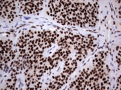 m03769 anti hnrnp l hnrnpl mouse monoclonal antibody clone id oti2e4 ihc testing 8