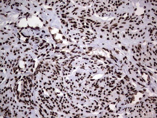 m03769 anti hnrnp l hnrnpl mouse monoclonal antibody clone id oti2e4 ihc testing 9