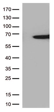 HEK293T cells were transfected with the pCMV6-ENTRY control (Left lane) or pCMV6-ENTRY SAG (Right lane) cDNA for 48 hrs and lysed