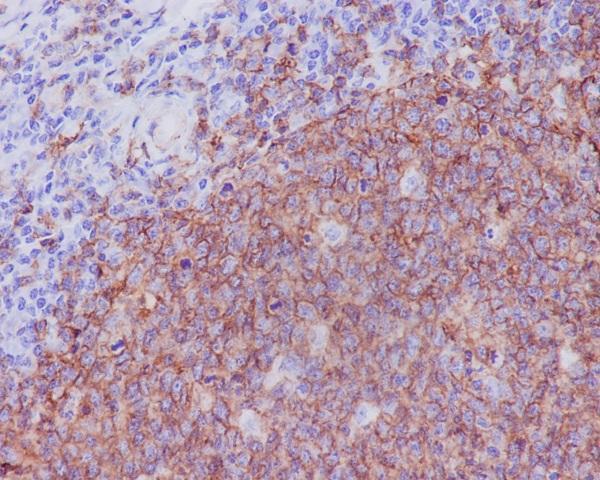 m03780 1 ihc