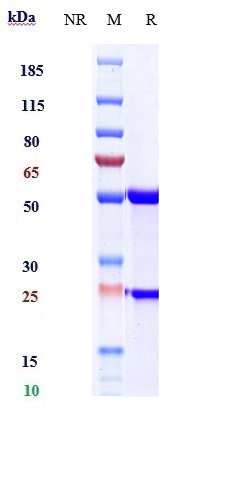 Anti-CD20 Reference Antibody (ocaratuzumab) on SDS-PAGE under reducing (R) condition