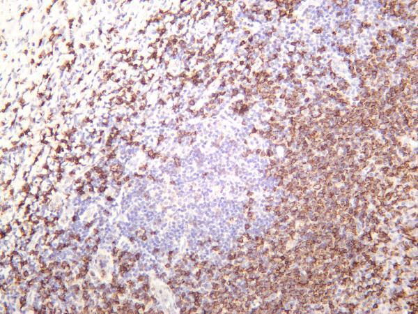 m03780 18 ms4a1 primary antibodies ihc testing 1