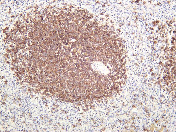 m03780 18 ms4a1 primary antibodies ihc testing 2