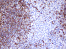 Immunohistochemical staining of paraffin-embedded Human tonsil within the normal limits using anti-MS4A1 mouse monoclonal antibody