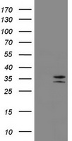 HEK293T cells were transfected with the pCMV6-ENTRY control (Left lane) or pCMV6-ENTRY MS4A1 (Right lane) cDNA for 48 hrs and lysed