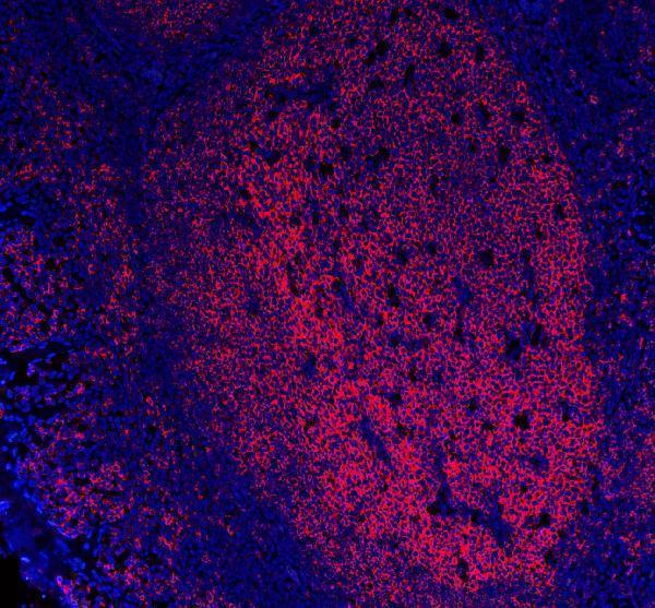  IF analysis of CD20/MS4A1 using anti-CD20/MS4A1 antibody (M03780-4)