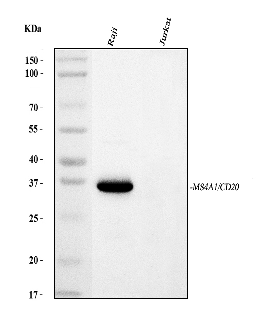  Western blot analysis of CD20/MS4A1 using anti-CD20/MS4A1 antibody (M03780-4)