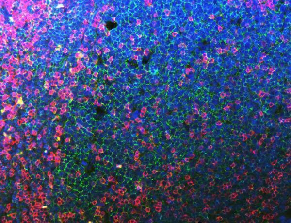 m03780 5 cd20 primary antibodies if testing 4_1