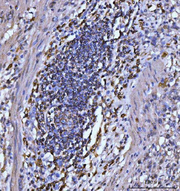  IHC analysis of CD20 using anti-CD20 antibody (M03780-5)