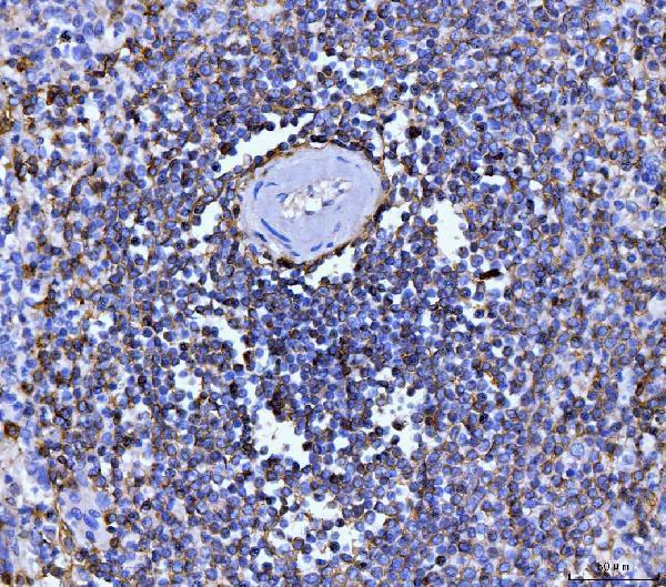  IHC analysis of CD20 using anti-CD20 antibody (M03780-5)