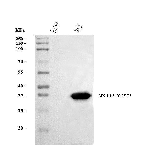 Western blot analysis of CD20 using anti-CD20 antibody (M03780-5)