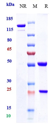 Anti-CD20 Reference Antibody (Regeneron patent anti-CD20) on SDS-PAGE under reducing (R) condition
