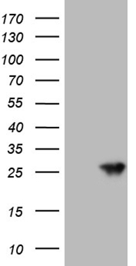m03784 anti serotonin n acetyltransferase aanat mouse monoclonal antibody clone id oti6e1 wb testing 1