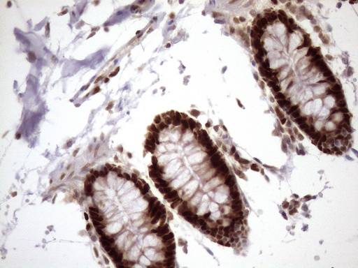 m03785 anti klf9 mouse monoclonal antibody clone id oti8a11 ihc testing 11