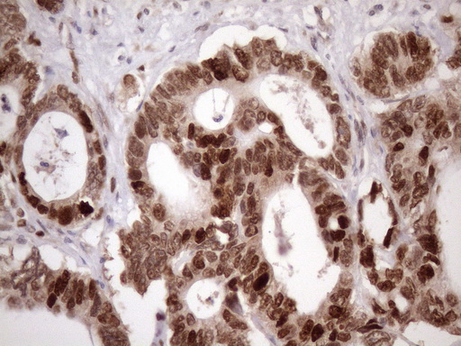 m03785 anti klf9 mouse monoclonal antibody clone id oti8a11 ihc testing 12