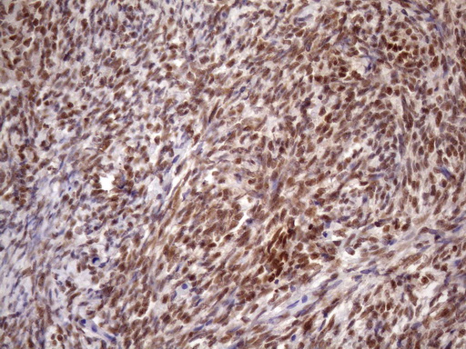 Immunohistochemical staining of paraffin-embedded Human Ovary tissue within the normal limits using anti-KLF9 mouse monoclonal antibody