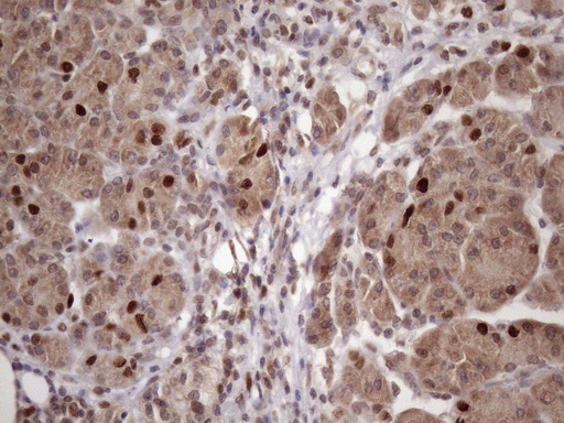 m03785 anti klf9 mouse monoclonal antibody clone id oti8a11 ihc testing 4