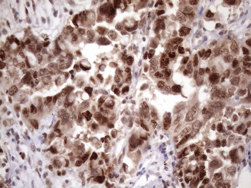 m03785 anti klf9 mouse monoclonal antibody clone id oti8a11 ihc testing 8