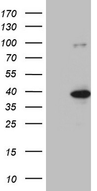 HEK293T cells were transfected with the pCMV6-ENTRY control (Left lane) or pCMV6-ENTRY KLF9 (Right lane) cDNA for 48 hrs and lysed