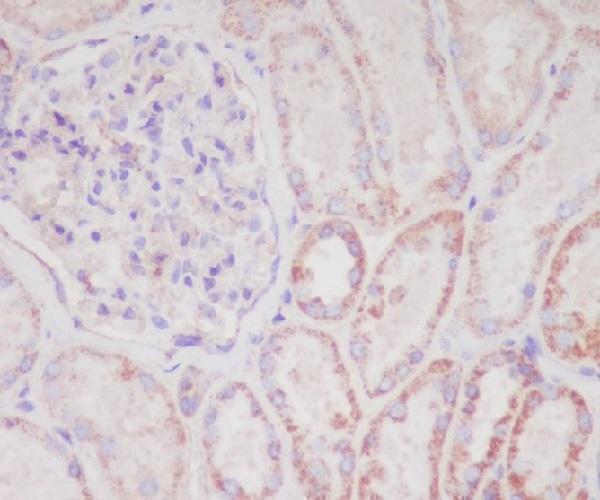 Immunohistochemical analysis of paraffin-embedded human kidney, using Smac/Diablo Antibody
