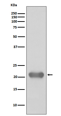 Western blot analysis of Smac/Diablo expression in Jurkat cell lysate