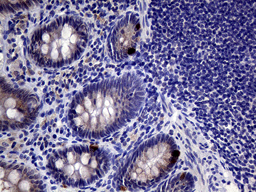 Immunohistochemical staining of paraffin-embedded Human colon tissue within the normal limits using anti-IL24 mouse monoclonal antibody