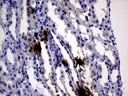 m03793 1 anti il24 mouse monoclonal antibody clone id oti3c5 ihc testing 4