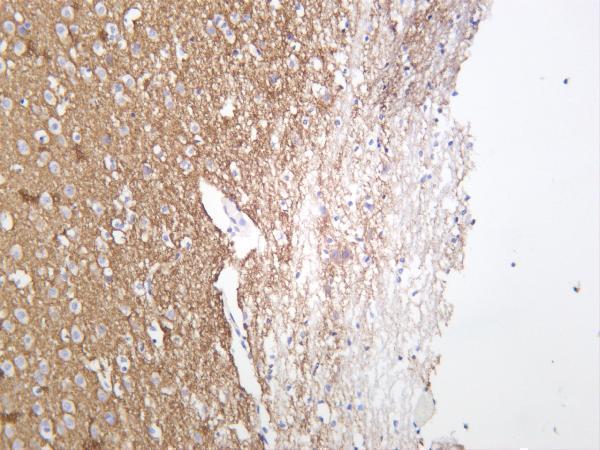m03794 1 syn1 primary antibodies ihc testing 3