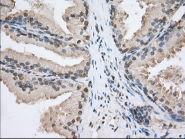 m03796 1 anti sh3px1 snx9 mouse monoclonal antibody clone id oti1b5 ihc testing 4