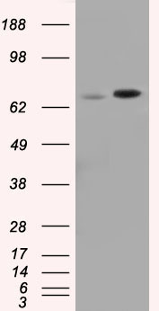 HEK293T cells were transfected with the pCMV6-ENTRY control (Left lane) or pCMV6-ENTRY SNX9 (Right lane) cDNA for 48 hrs and lysed