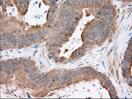 m03796 anti sh3px1 snx9 mouse monoclonal antibody clone id oti1e2 ihc testing 5