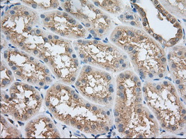 m03796 anti sh3px1 snx9 mouse monoclonal antibody clone id oti1e2 ihc testing 6