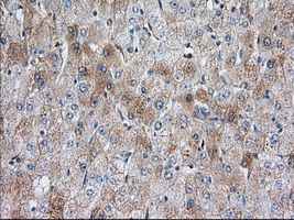 m03796 anti sh3px1 snx9 mouse monoclonal antibody clone id oti1e2 ihc testing 7