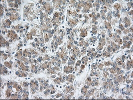 m03796 anti sh3px1 snx9 mouse monoclonal antibody clone id oti1e2 ihc testing 8