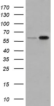 HEK293T cells were transfected with the pCMV6-ENTRY control (Left lane) or pCMV6-ENTRY SNX9 (Right lane) cDNA for 48 hrs and lysed