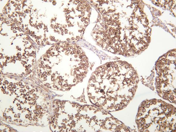 Mouse testis was stained with anti-ITGB6 rabbit antibody