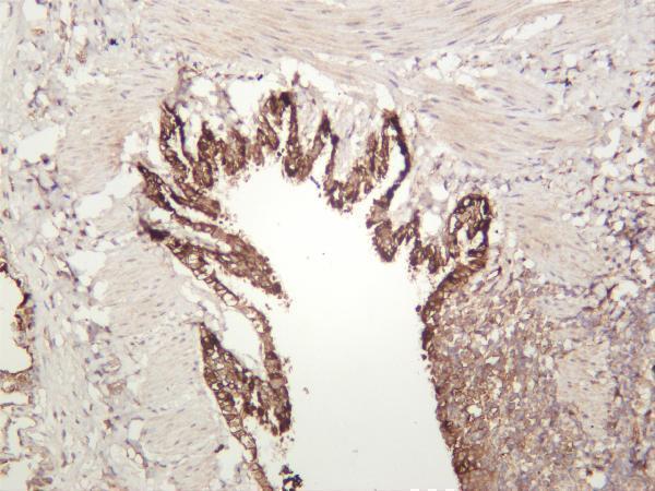 Rat lung was stained with anti-ITGB6 rabbit antibody