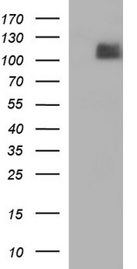 HEK293T cells were transfected with the pCMV6-ENTRY control (Left lane) or pCMV6-ENTRY ITGB6 (Right lane) cDNA for 48 hrs and lysed. Equivalent amounts of cell lysates (5 ug per lane) were separated by SDS-PAGE and immunoblotted with anti-ITGB6.