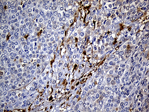 m03804 anti csps sult1a3 mouse monoclonal antibody clone id oti6a8 ihc testing 8