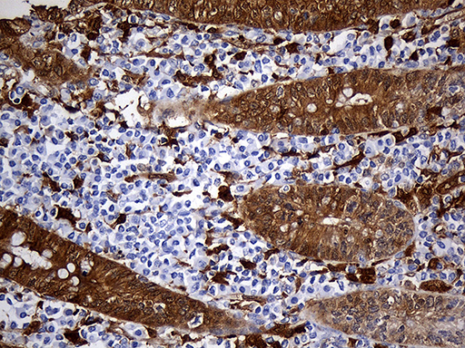 m03804 anti csps sult1a3 mouse monoclonal antibody clone id oti6a8 ihc testing 9